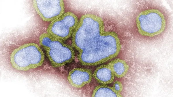 Sergipe em Alerta de Saúde : Influenza A em Alta e Vacinação se Aproxima – Entenda os Riscos e a Campanha