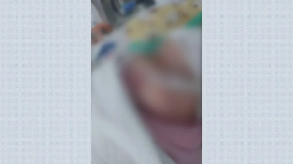 Bebê Com Objeto No Pulmão em Sergipe: Cirurgia Bem-Sucedida, Mas Pequena Segue na UTI