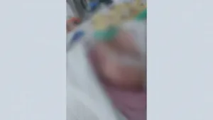 Bebê Com Objeto No Pulmão em Sergipe: Cirurgia Bem-Sucedida, Mas Pequena Segue na UTI