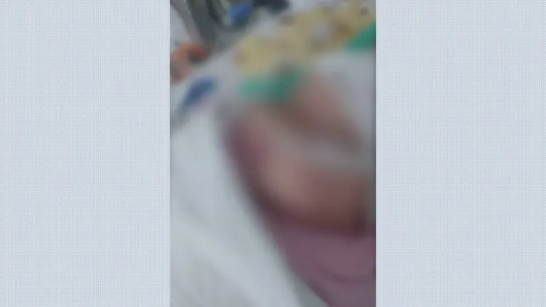 Bebê Com Objeto No Pulmão em Sergipe: Cirurgia Bem-Sucedida, Mas Pequena Segue na UTI